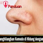 Cara Menghilangkan Komedo di Hidung dengan Cepat